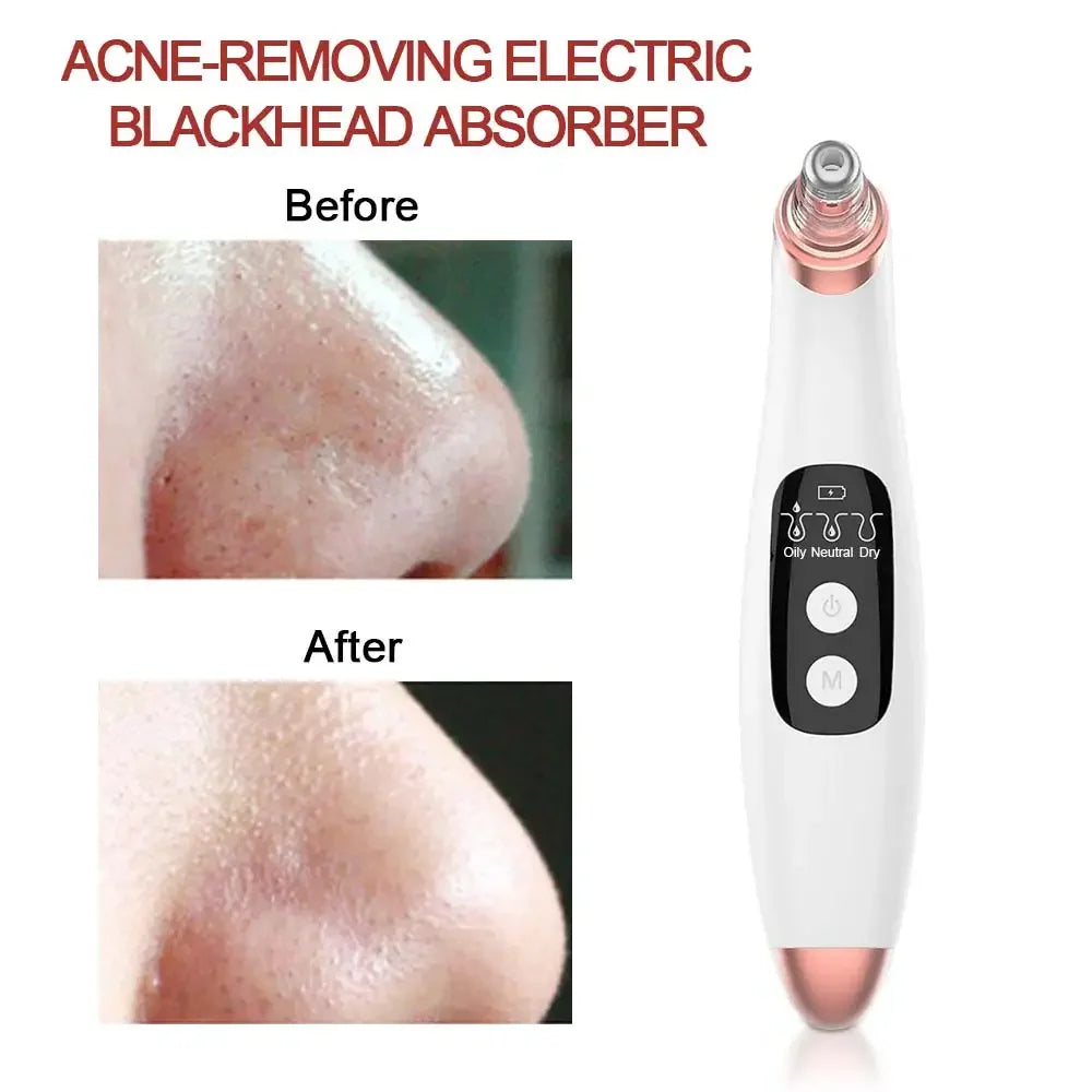 Microcrystal Pore Cleaner